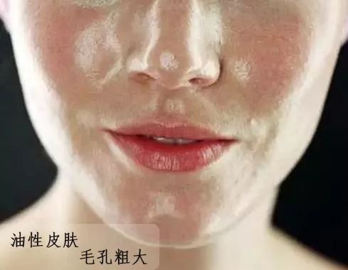 怎么判断自己什么肤质