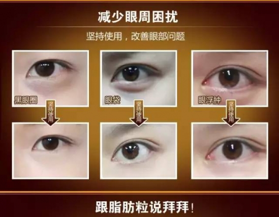 眼部保养的方法