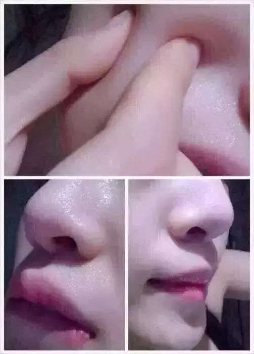女性脸色发黄是什么原因