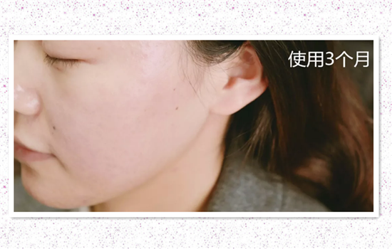 资生堂红腰子和兰蔻小黑瓶哪个好 红腰子精华和小黑瓶
