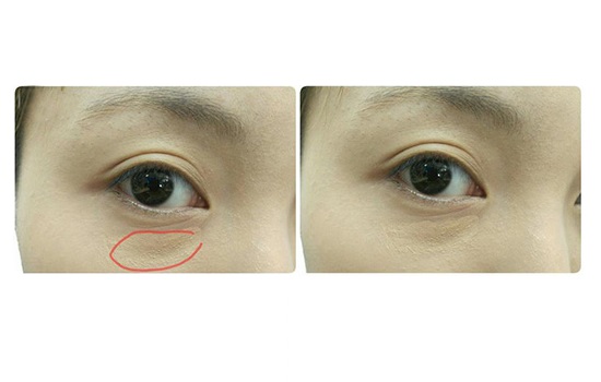 如何用遮瑕膏 怎么使用遮瑕膏