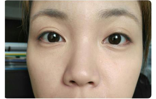 遮瑕膏怎么遮眼袋 遮瑕膏如何遮眼袋