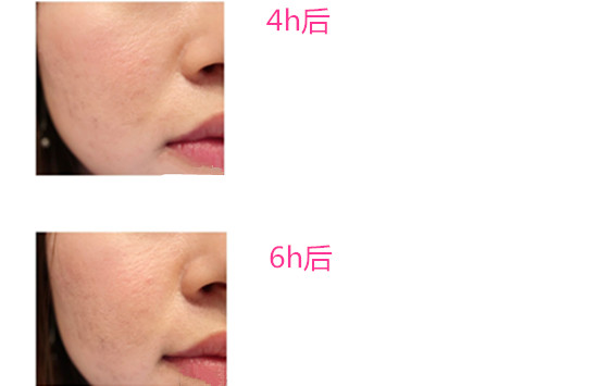 兰蔻奇迹薄纱粉底液怎么样 兰蔻奇迹薄纱粉底液好用吗