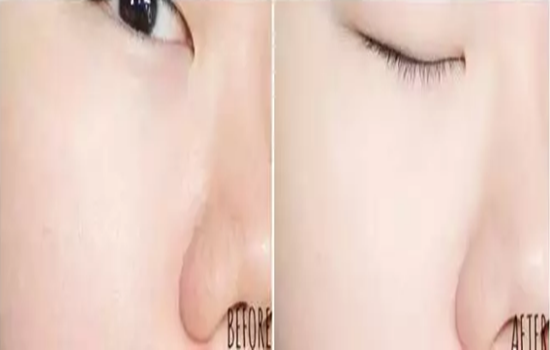 资生堂完美意境粉底霜怎么样 Shiseido粉底液