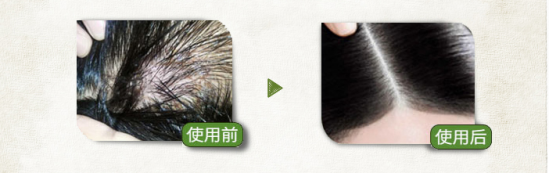 所望洗发水哪款好 所望植物洗发水怎么样