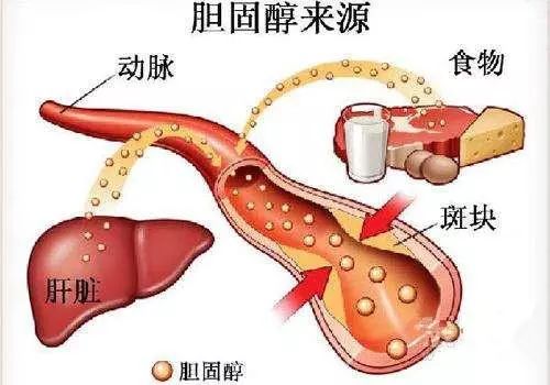 胆固醇高吃什么好