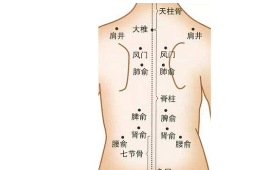 拔罐祛湿位置图 拔罐去湿气的位置图