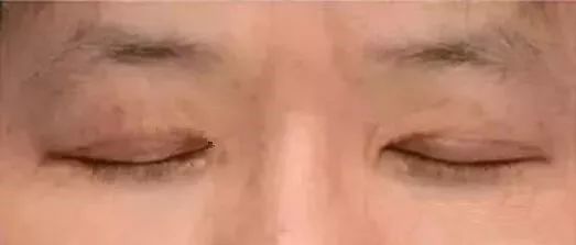 心脏不好有什么症状