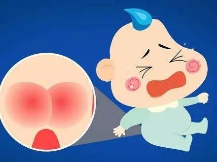 刚出新生儿怎么护理