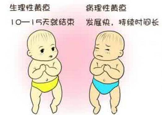 刚出新生儿怎么护理