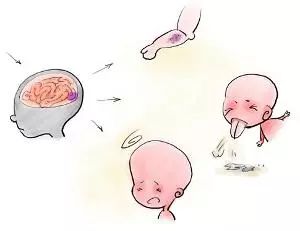 a群流脑疫苗不良反应