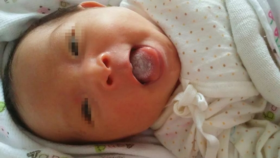 为什么母乳喂养的宝宝会消化不良
