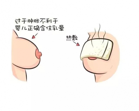 产后胀奶的解决方法