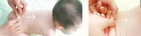 小儿推拿适合多大的孩子