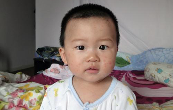 幼儿急疹能吹风吗 幼儿急疹能见风吗