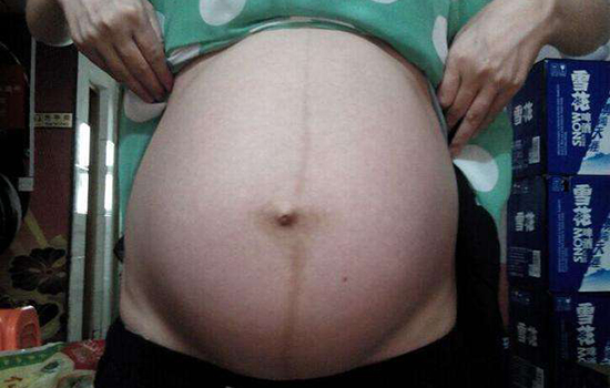 孕妇肚子痒是男孩女孩 孕妇肚子痒男孩还是女孩