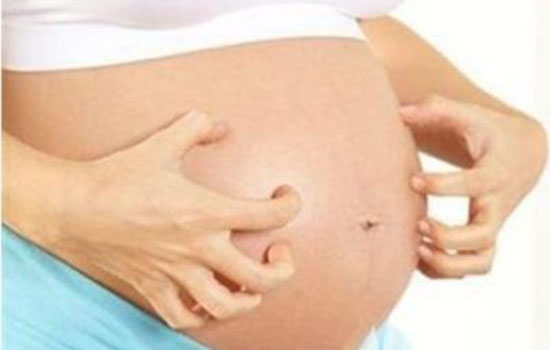 孕妇肚子痒能抓吗 孕妇肚子痒为什么不能抓