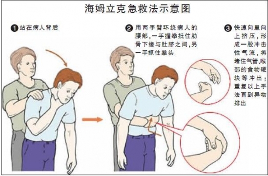 宝宝吃坚果卡住怎么办 宝宝吃坚果噎住怎么办