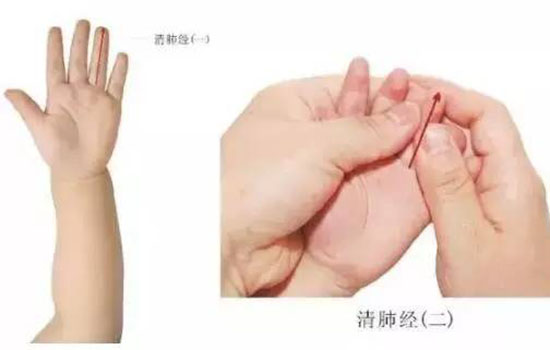 小儿荨麻疹推拿手法图 小儿推拿治疗荨麻疹