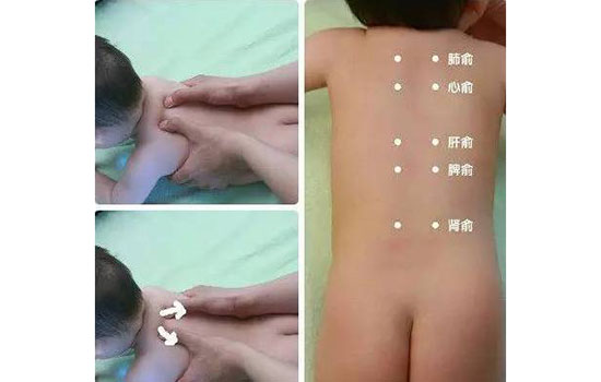 小儿肺炎推拿手法图解 小儿肺炎怎么推拿