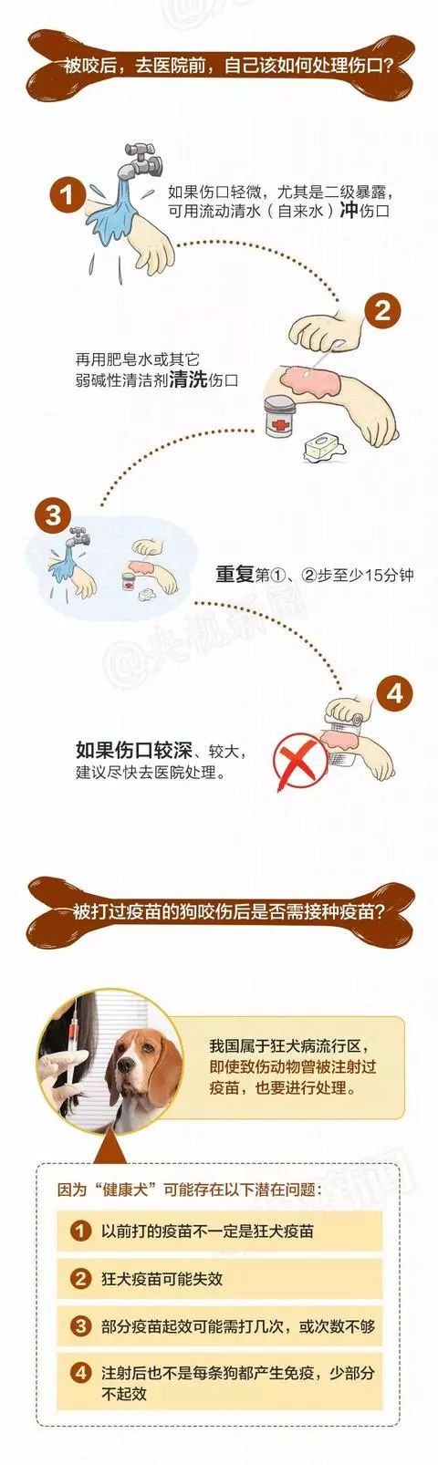 小孩被狗咬了怎么办 孩子让狗咬了怎么办