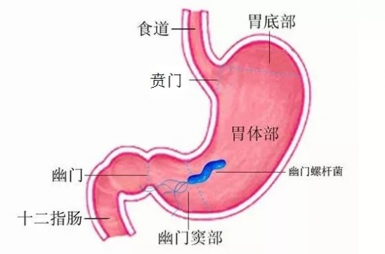 如何预防感染幽门螺杆菌 预防感染幽门螺杆菌方法