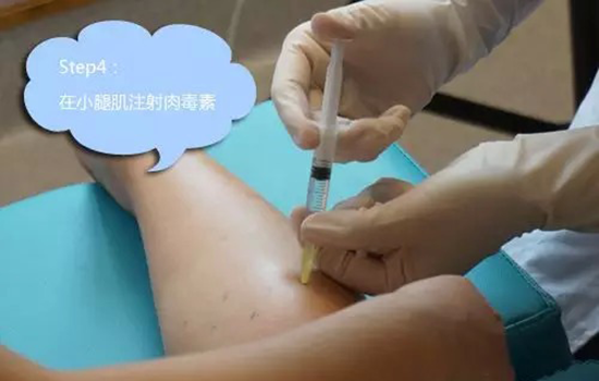 打瘦腿针过程图 瘦腿针的注射方法如下