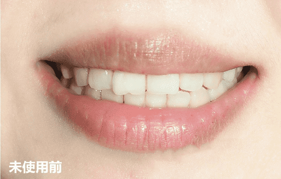 COSMO WHITE牙齿美白贴怎么样 COSMO WHITE牙齿美白贴使用方法