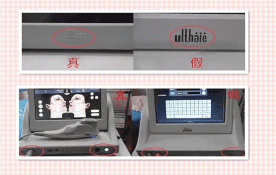 做超声刀前要注意什么 超声刀前注意事项