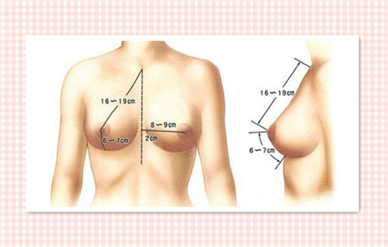 假体隆胸能母乳吗 假体隆胸可以喂奶吗