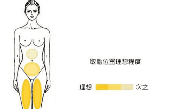 自体脂肪丰胸好不好 自体脂肪丰胸好不好