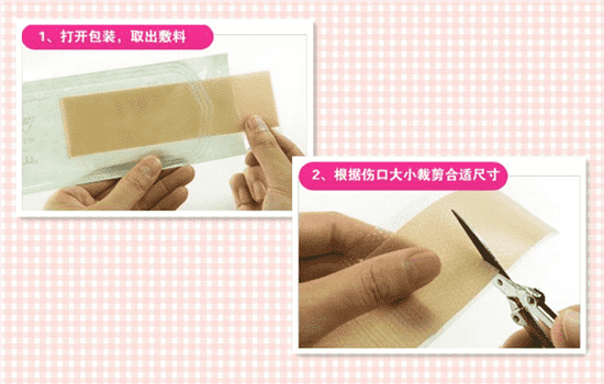 开眼角后用什么祛疤药 开眼角后用什么药膏