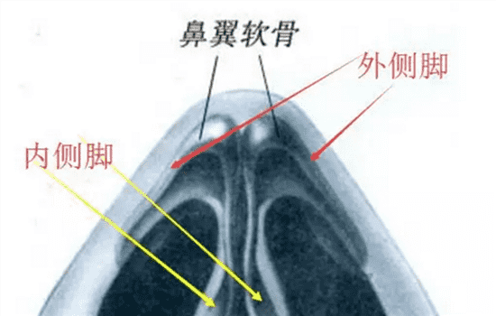 鼻头缩小怎么做 鼻头缩小手术怎么治疗