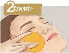 线雕是什么