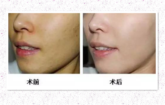 白瓷娃娃效果怎么样 白瓷娃娃效果如何