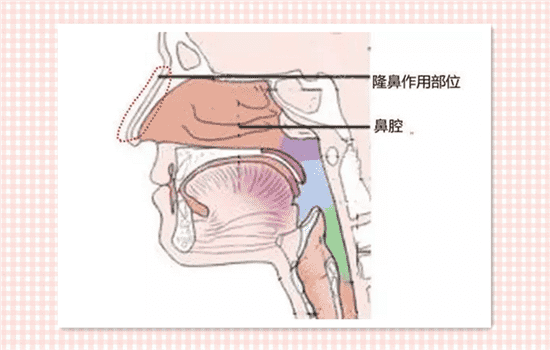 有鼻炎能做隆鼻吗 有鼻炎可以做隆鼻吗