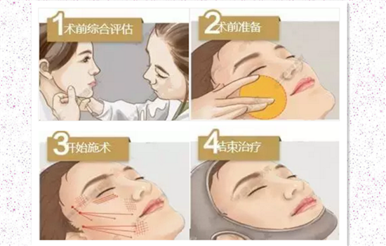 童颜针是什么成分 童颜针是生长因子吗