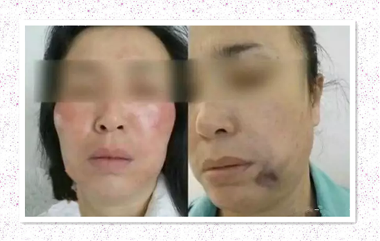 奥美定摸起来是软的么 奥美定手感是硬是软