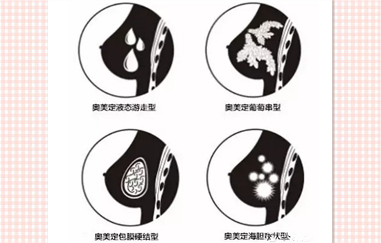 奥美定摸起来是软的么 奥美定手感是硬是软