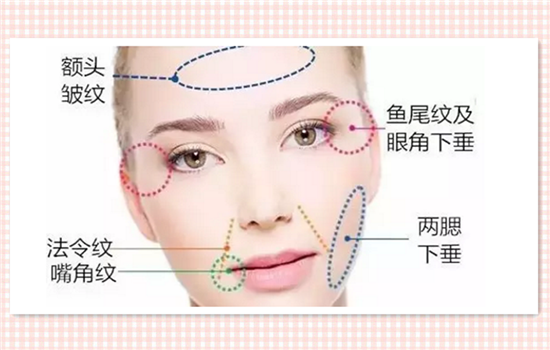 埋线提升的危害 埋线提升有后遗症吗