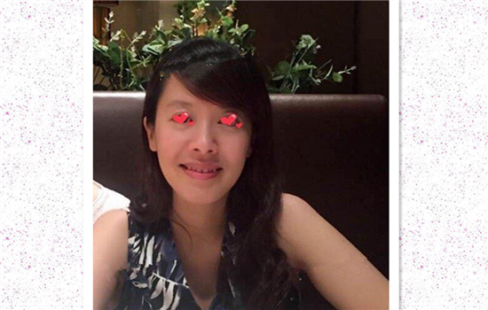 热玛吉案例 做热玛吉的亲身经历