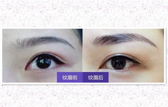 什么叫轻氧眉 什么是氧气眉