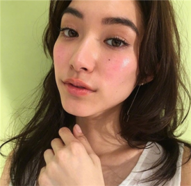 玻尿酸打下巴能喝酒吗