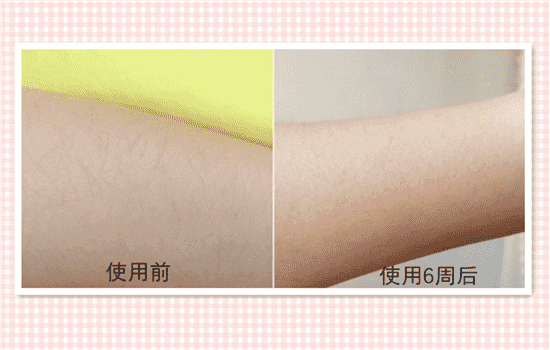 silkn脱毛仪好用吗 丝可脱毛仪怎么样