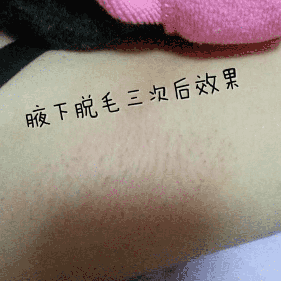 雅萌脱毛仪效果怎么样 雅萌脱毛仪有用吗