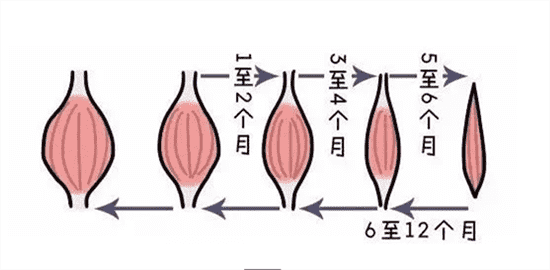 瘦肩针可以缓解疲劳吗