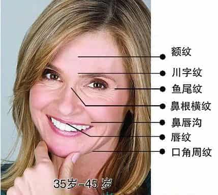 打肉毒素的作用