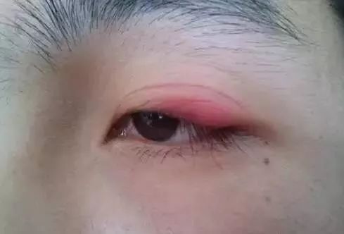 美瞳线和眼线有什么区别 美瞳线是什么