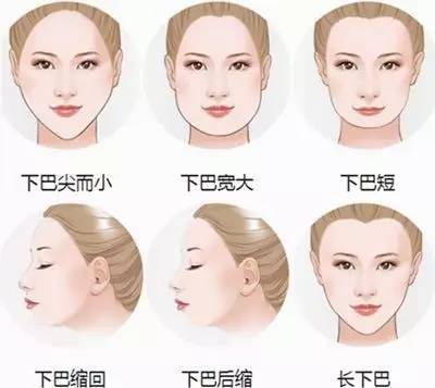 玻尿酸注射后注意事项 玻尿酸注射下巴后注意事项