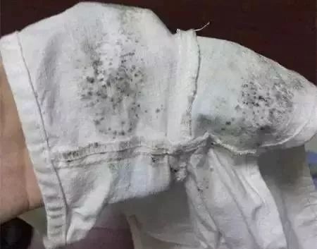衣服发霉怎么清洗
